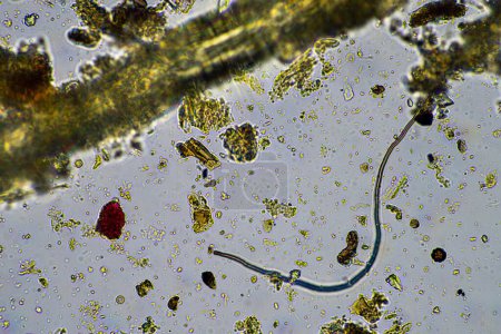 Photo for Soil microorganisms close up under the microscope. in soil from a farm - Royalty Free Image