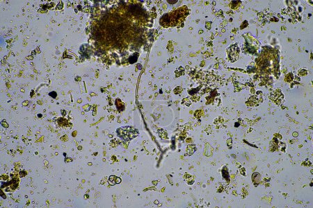 Foto de Microorganismos del suelo, incluidos nematodos, microartrópodos, microartrópodos, tardígrados y rotíferos: una muestra de suelo, hongos y bacterias del suelo en una granja regenerativa de compost - Imagen libre de derechos