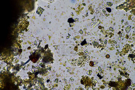 Mikroorganismen und Bodenbiologie mit Nematoden und Pilzen unter dem Mikroskop. in einer Boden- und Kompostprobe im Labor