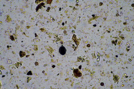Téléchargez les photos : Micro-organismes et biologie du sol, avec nématodes et champignons au microscope. dans un échantillon de sol et de compost dans un laboratoire - en image libre de droit
