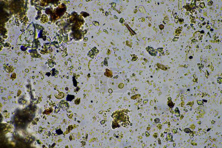 Bodenmikroorganismen nähern sich unter dem Mikroskop. im Boden von einem Bauernhof