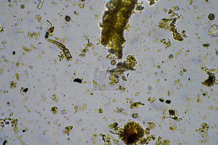 Téléchargez les photos : Champignons et micro-organismes du sol dans un échantillon de sol et de compost - en image libre de droit