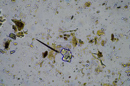 Foto de Microorganismos del suelo se cierran bajo el microscopio. en el suelo de una explotación - Imagen libre de derechos