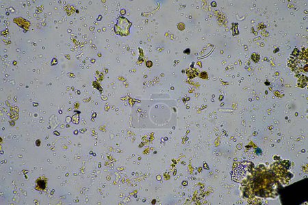 Photo for Soil microorganisms close up under the microscope. in soil from a farm - Royalty Free Image