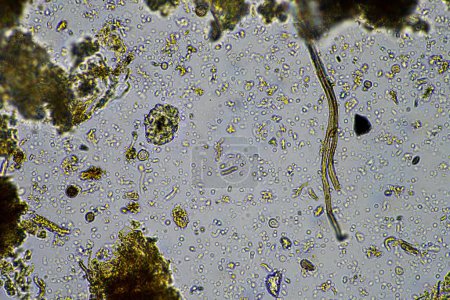 Foto de Microorganismos del suelo se cierran bajo el microscopio. en el suelo de una explotación - Imagen libre de derechos