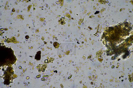 Téléchargez les photos : Les micro-organismes du sol se ferment sous le microscope. dans le sol d'une ferme - en image libre de droit