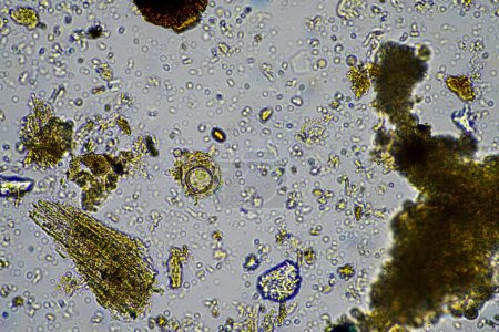 Foto de Microorganismos del suelo, incluidos nematodos, microartrópodos, microartrópodos, tardígrados y rotíferos: una muestra de suelo, hongos y bacterias del suelo en una granja regenerativa de compost - Imagen libre de derechos