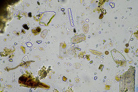 Téléchargez les photos : Champignon et hyphes fongiques dans un échantillon de sol d'une ferme, microorganismes et biologie du sol - en image libre de droit