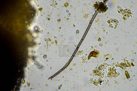 Téléchargez les photos : Champignon et hyphes fongiques dans un échantillon de sol d'une ferme, microorganismes et biologie du sol - en image libre de droit