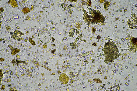 Téléchargez les photos : Échantillon de sol contenant la biologie du sol, avec bactéries, champignons, amibes, flagellés et arcella, dans une ferme agricole durable en Australie - en image libre de droit