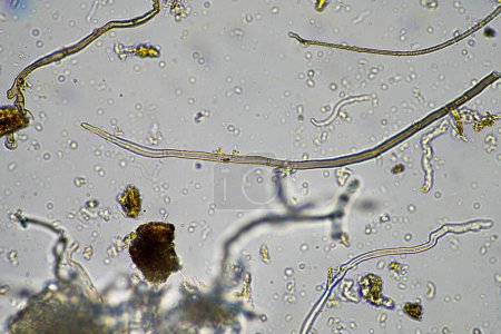 Mikroorganismen und Bodenbiologie mit Nematoden und Pilzen unter dem Mikroskop. in Erde und Kompost 