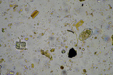 Téléchargez les photos : Micro-organismes et biologie du sol, avec nématodes et champignons au microscope. dans un sol et un compost - en image libre de droit