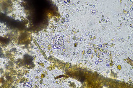 Téléchargez les photos : Microorganismes microscopiques au microscope - en image libre de droit