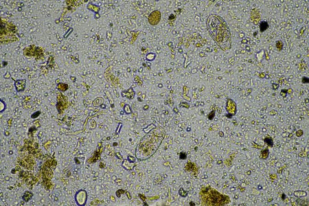 Téléchargez les photos : Champignon microscopique et micro-organismes dans un échantillon en Australie - en image libre de droit