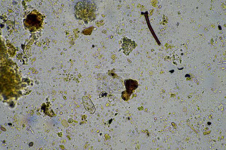 Foto de Hongos microscópicos y microorganismos en una muestra en Australia - Imagen libre de derechos