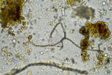 Téléchargez les photos : Champignon microscopique et micro-organismes dans un échantillon en Australie - en image libre de droit
