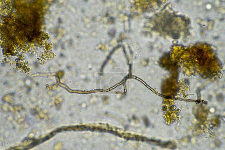 Téléchargez les photos : Microbes du sol sous le microscope. micro-organismes avec champignon dans le compost - en image libre de droit