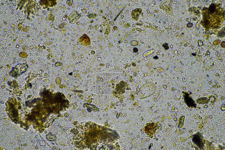 Téléchargez les photos : Microorganismes et biologie dans les échantillons de compost et de sol au microscope - en image libre de droit