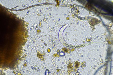 Téléchargez les photos : Microbes du sol sous le microscope. micro-organismes avec champignon dans le compost - en image libre de droit