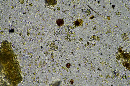 Téléchargez les photos : Microorganismes et biologie dans les échantillons de compost et de sol au microscope - en image libre de droit