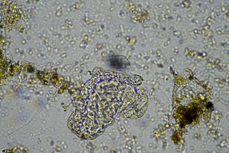 Téléchargez les photos : Micro-organismes et un tardigrade dans un échantillon de sol d'une ferme - en image libre de droit