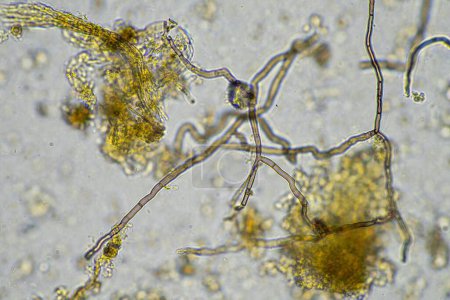 Téléchargez les photos : Microorganismes microscopiques au microscope - en image libre de droit