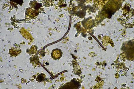 Bodenmikroorganismen unter dem Mikroskop beim Recycling von Nährstoffen in einem Kompost auf einem regenerativen Bauernhof in Australien, mit Amöben, Pilzen, Pilzen, Mikroben und Nematoden im Frühjahr