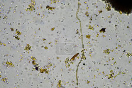 Bodenmikroorganismen unter dem Mikroskop beim Recycling von Nährstoffen in einem Kompost auf einem regenerativen Bauernhof in Australien, mit Amöben, Pilzen, Pilzen, Mikroben und Nematoden im Frühjahr
