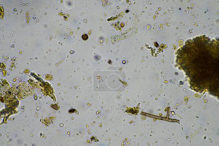 Téléchargez les photos : Micro-organisme du sol au microscope recyclage des nutriments dans un compost sur une ferme agricole régénérative en Australie, montrant amibe, champignons, champignons, microbes et nématodes au printemps - en image libre de droit