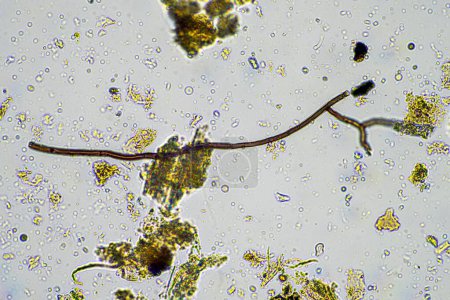 Mikroorganismen und Bodenbiologie mit Nematoden und Pilzen unter dem Mikroskop. in einer Boden- und Kompostprobe in Australien