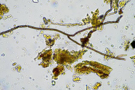 Pilzhyphen und Bodenpilze in einer Bodenprobe, die den lebenden Boden einer Farm unter dem Mikroskop zeigt