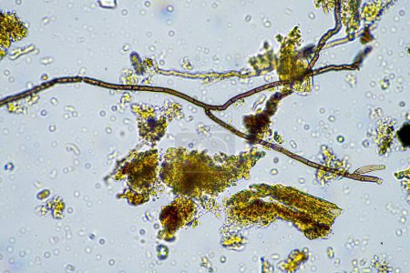 Téléchargez les photos : Micro-organismes du sol dans un échantillon de vie du sol provenant d'une ferme agricole durable. réseaux trophiques vivants ou bactéries champignons et protozoaires en Australie - en image libre de droit