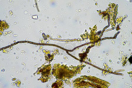 hyphes fongiques et champignons du sol dans un échantillon de sol, montrant que le sol vivant forme une ferme au microscope