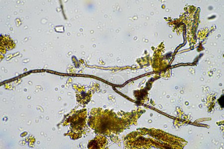 Photo for Microorganisms and soil biology, with nematodes and fungi under the microscope. in a soil and compost sample in australia - Royalty Free Image