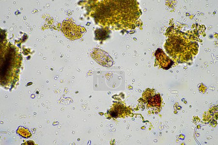 microorganismos y biología del suelo, con nematodos y hongos bajo el microscopio. en una muestra de suelo y compost en Australia