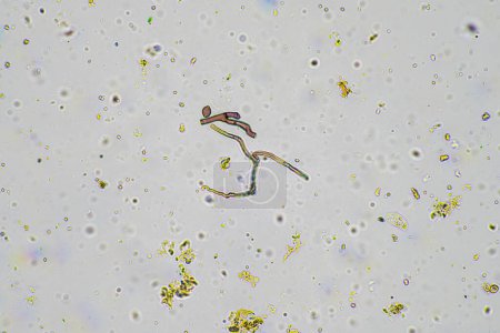 soil microorganisms in a soil life sample from a sustainable agriculture farm. living food web or bacteria fungi and protozoa in australia