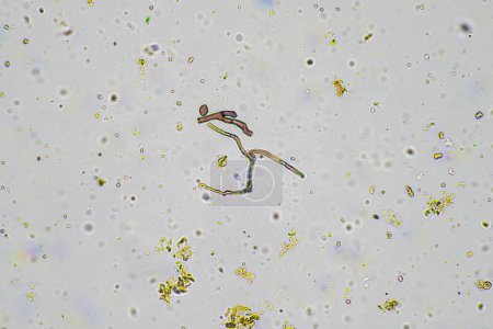 fungal hyphae and soil fungi in a soil sample, showing the living soil form a farm under the microscope