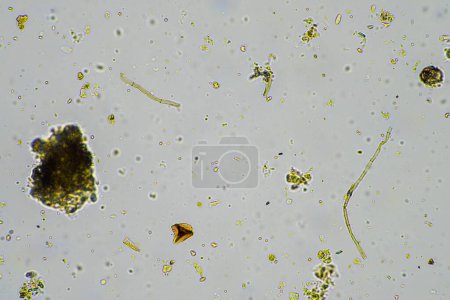 hyphes fongiques et champignons du sol dans un échantillon de sol, montrant que le sol vivant forme une ferme au microscope