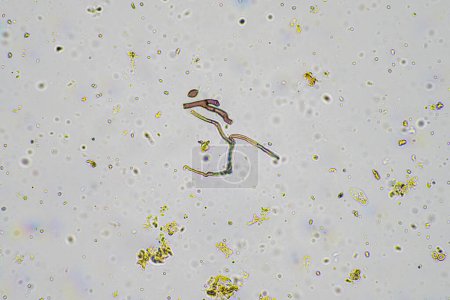 Téléchargez les photos : Micro-organismes et biologie du sol, avec nématodes et champignons au microscope. dans un échantillon de sol et de compost en Australie - en image libre de droit