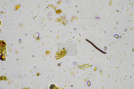 micro-organismes et biologie du sol, avec nématodes et champignons au microscope. dans un échantillon de sol et de compost en Australie