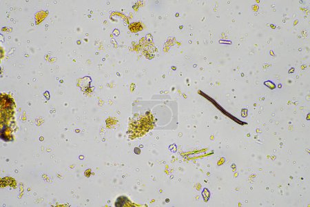 hifas fúngicas y hongos del suelo en una muestra de suelo, mostrando que el suelo vivo forma una granja bajo el microscopio