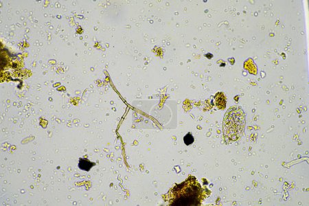 Mikroorganismen und Bodenbiologie mit Nematoden und Pilzen unter dem Mikroskop. in einer Boden- und Kompostprobe in Australien