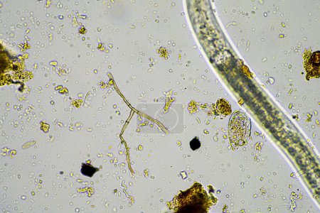 Pilzhyphen und Bodenpilze in einer Bodenprobe, die den lebenden Boden einer Farm unter dem Mikroskop zeigt