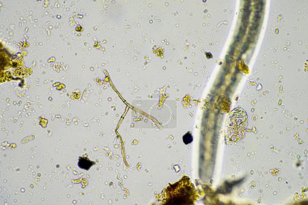 Téléchargez les photos : Micro-organismes du sol dans un échantillon de vie du sol provenant d'une ferme agricole durable. réseaux trophiques vivants ou bactéries champignons et protozoaires en Australie - en image libre de droit