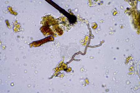 hifas fúngicas y hongos del suelo en una muestra de suelo, mostrando que el suelo vivo forma una granja bajo el microscopio