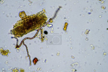 microorganisms and soil biology, with nematodes and fungi under the microscope. in a soil and compost sample in australia