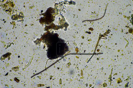 Boden unter dem Mikroskop, Blick auf Sand, Schlamm und Lehm und Bodenbiologie, Amöben, Pilze, Pilze, Mikroben und Nematoden in einer Rinderfarm