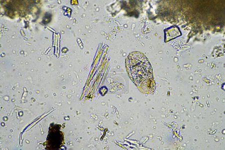 soil microorganisms under a microscope including amoeba, flagellates, nematodes, fungi, bacteria, from a soil sample on a regenerative agriculture farm in Australia in a lab