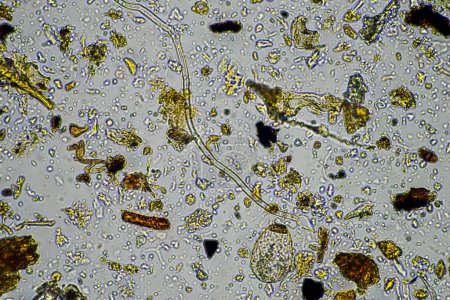 soil microorganisms under a microscope including amoeba, flagellates, nematodes, fungi, bacteria, from a soil sample on a regenerative agriculture farm in Australia in a lab