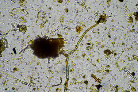 Boden unter dem Mikroskop, Blick auf Sand, Schlamm und Lehm und Bodenbiologie, Amöben, Pilze, Pilze, Mikroben und Nematoden in einer Rinderfarm